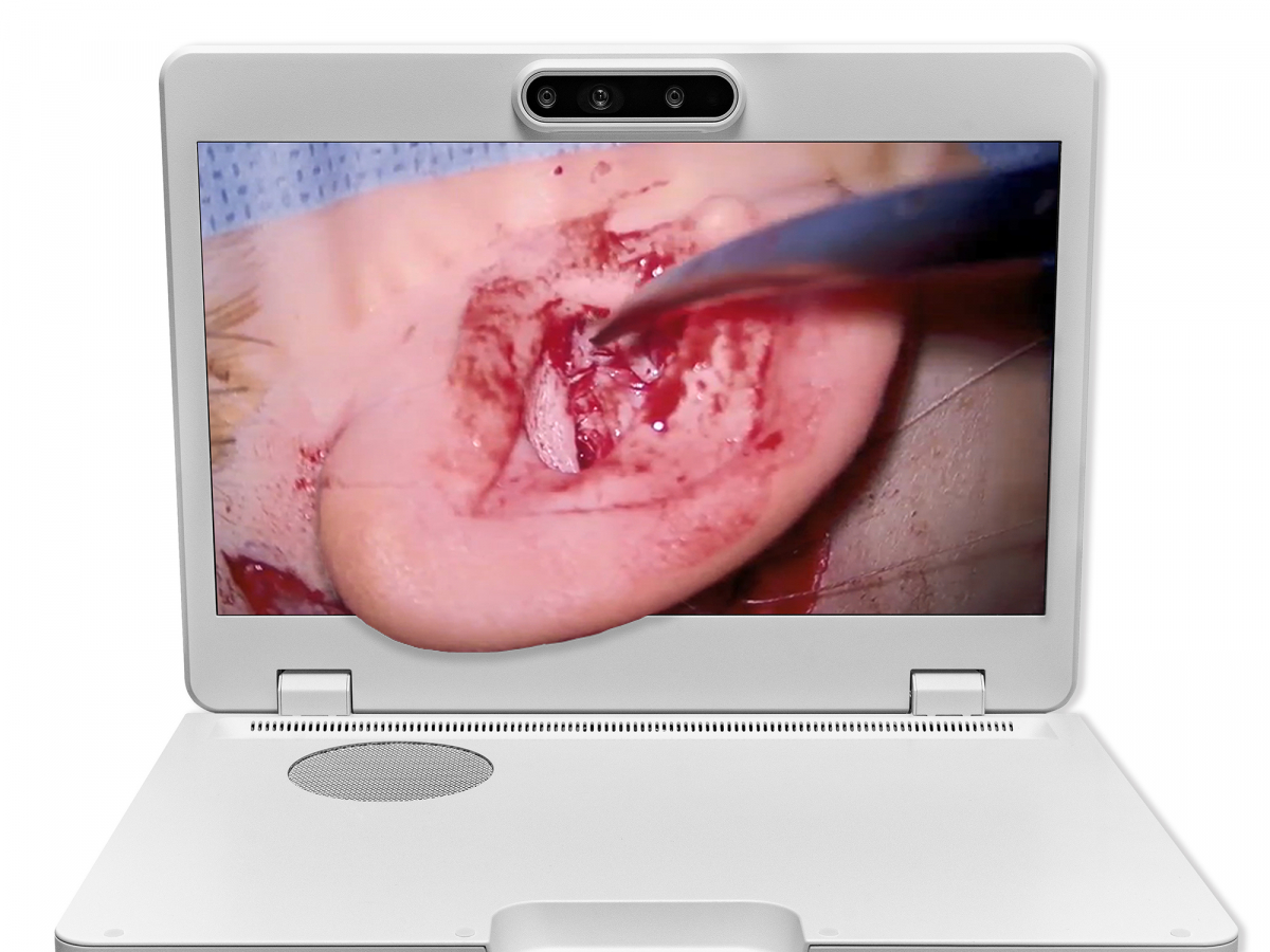 达擎之＂Heads-up 3D显微手术显示系统＂，整合4K裸眼3D显示及眼球追踪系统，具备快速追踪人眼移动位置功能，减轻医师长时间维持固定姿势的负担，让医师能有更宽广清晰的3D立体视野及更舒适的姿势来执行手术。